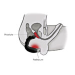 Stimulator Prostata Cheeky Boy 7 Viteze